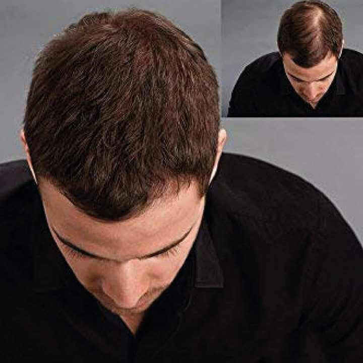 KÖ-HAIR FIBERS 30g Haarverdichter, Streuhaar, Schütthaar